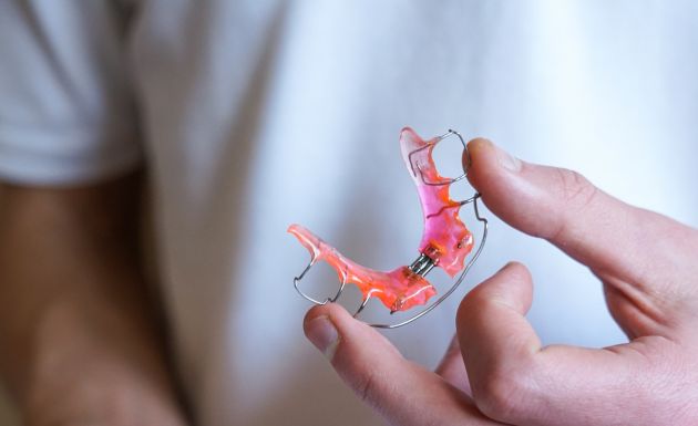 Removable Braces