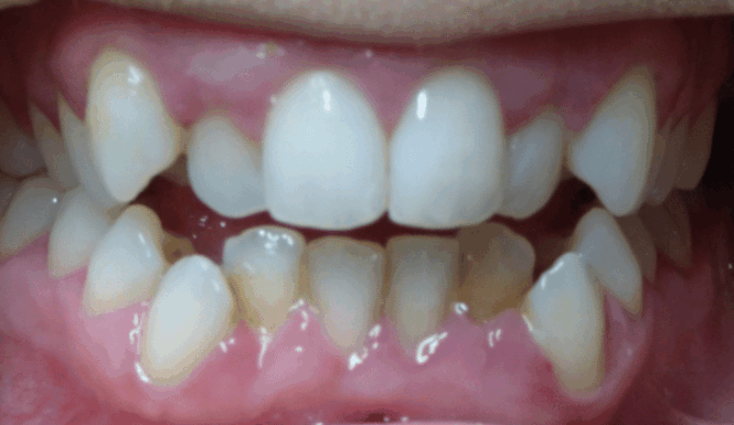 Before - DNTL Smiles