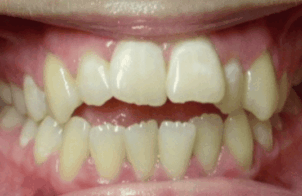 Before - DNTL Smiles