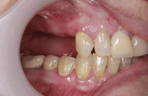 Before - DNTL Smiles