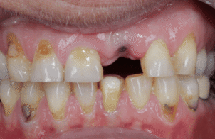 Before - DNTL Smiles