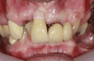 Before - DNTL Smiles