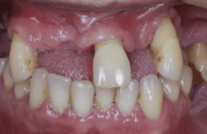 Before - DNTL Smiles