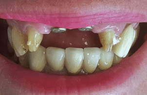 Before - DNTL Smiles