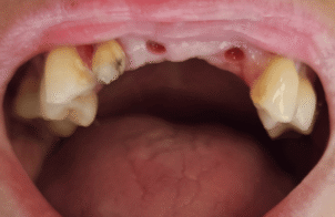 Before - DNTL Smiles