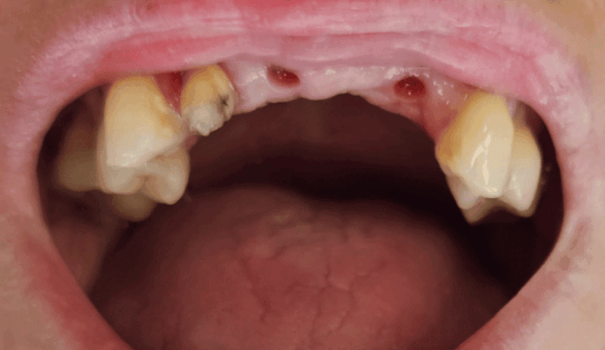 Before - DNTL Smiles & Wellness