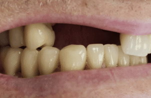 Before - DNTL Smiles